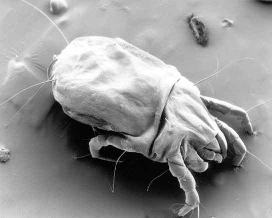 A photo of a dust mite